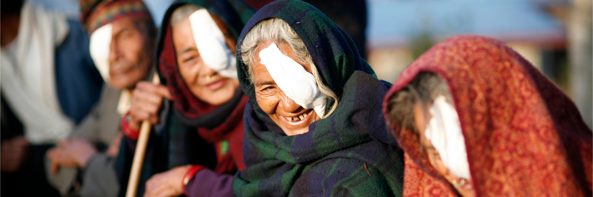 Vier vrouwen in Nepal na hun staaroperatie op een rij